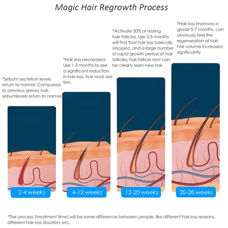 Red Light 81 Laser Hair Growth Cap